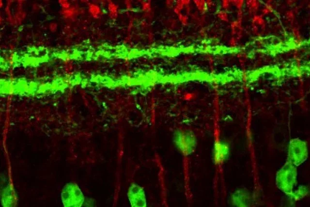 Cell bodies in the mouse retina.