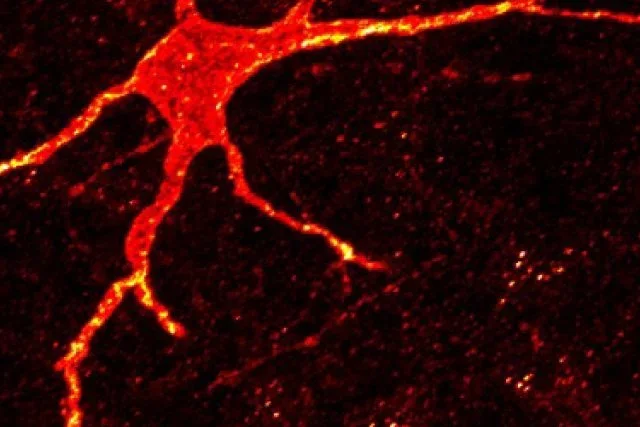 Confocal image of estrogen action on μ-opioid receptor activation.