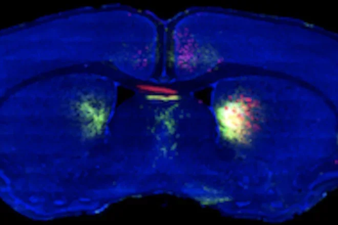 3D reconstruction of a mouse brain scanned with multi photon and confocal microscopies.