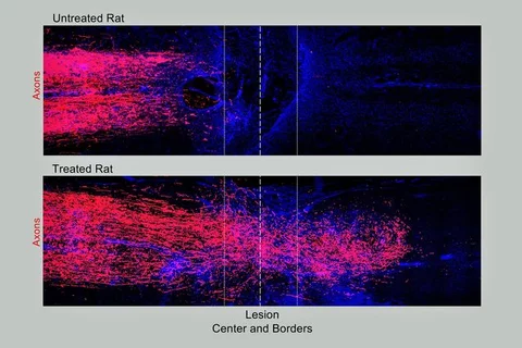 At top, spinal cord tissue in an untreated rat shows the damaged axons stopping at the border of the injury. Bottom image shows that the axons in a treated rat regrew across the spinal cord injury, creating new connections in tissue on the other side.