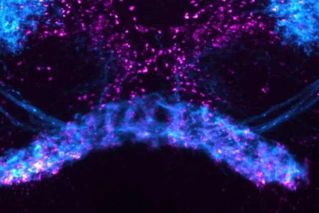 Neurons in the fruit fly brain.